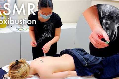 ASMR moxibustion and full body accupuncture (Unintentional, real person asmr) [Chinese Medicine]