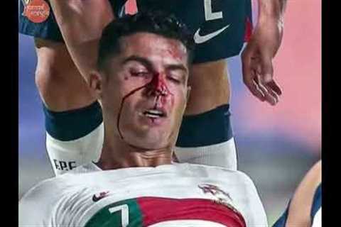 Cristiano Ronaldo bloodied Portugal Match #shorts l Ronaldo Injured Portugal vs Czech Republic #cr7