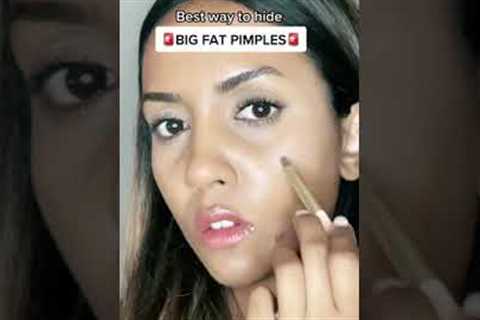 HIDE BIG PIMPLES (MAKEUP HACK)