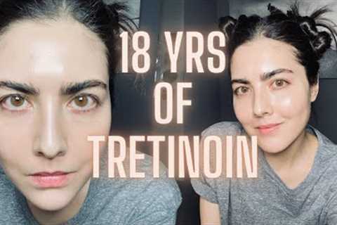 Not Seeing Results with Retin-A (TRETINOIN)? Watch This Before You Quit &amp; Avoid My Biggest..