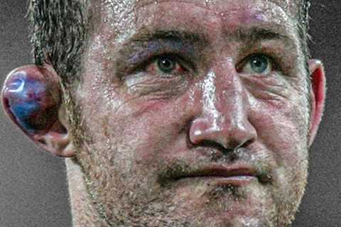 Rugby Is Painful | The Most Brutal Big Hits &amp; Moments Of Carnage