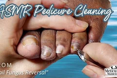 👣ASMR Pedicure Cleaning💆‍♀️Nail Fungus Reversal👣