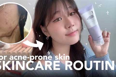Korean Skin Care Routine for acne-prone skin ✨