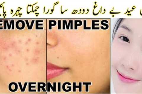 Reduce Pimples Acne Naturally At Home | How To Get Flawless Glass Skin | Glowing Skin Face Pack