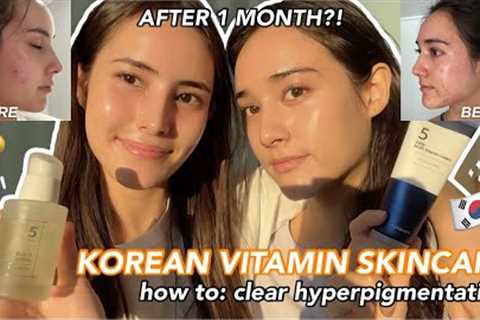 HOLY GRAIL Korean *vitamin* skincare for hyperpigmentation ✨ bright &amp; glowy skin in just 1..