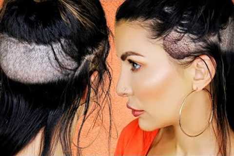 I Got A Hair Transplant | My Emotional Female Hair Transplant Surgery Experience