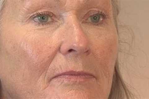 How To Conceal Wrinkles