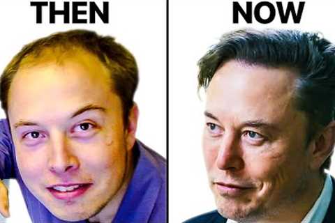 Elon Musk's Hair Transplant | Surgeon Reacts