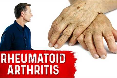 Use These Spices and Herbs for Rheumatoid Arthritis – Remedies for Rheumatoid Arthritis – Dr.Berg