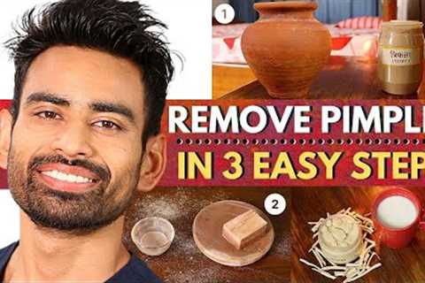 ULTIMATE Ayurvedic Routine to Get Rid of Pimples &amp; Acne Permanently (Men &amp; Women)