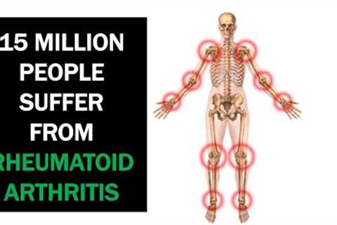 Natural Remedies For Rheumatoid Arthritis That Work