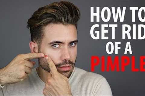 How To Get Rid of a Pimple Overnight | Fast Pimple and Acne Treatments | Alex Costa