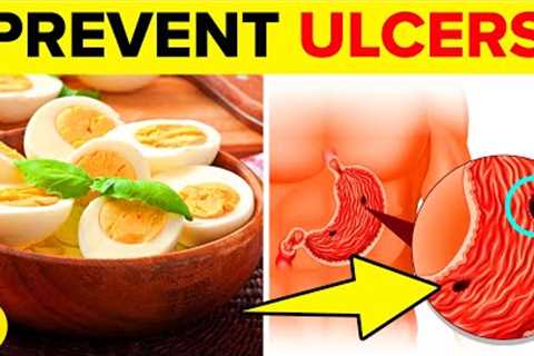 11 Best Foods To Prevent Ulcers