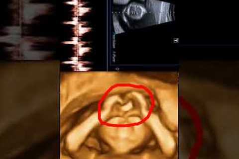 Baby making heart emoji in mother's womb👶❤ Development Of The Baby In The Womb Month By Month👶❤