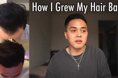 How I Grew My Hair Back  | My Hair Loss Journey and Treatment