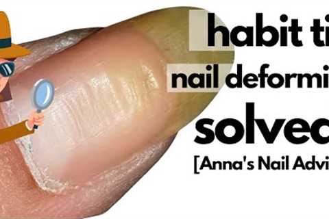 Uneven ridgy thumbnails |  Habit Tic Nail Deformity SOLVED!