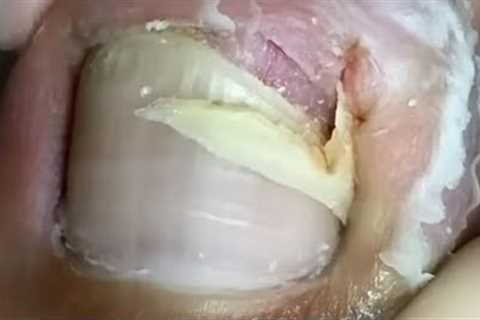 Huge hook! The excavated armor is amazing【Crazy pedicure room】