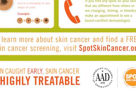 What you need to know for May, National Skin Cancer Awareness Month