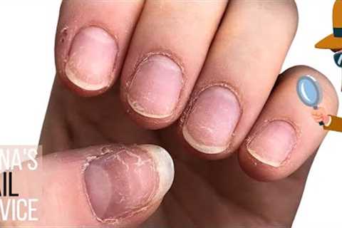 Nail damage, HEMA fears, allergic reactions &amp; what nail tech doesn't tell you. [Anna's Nail..