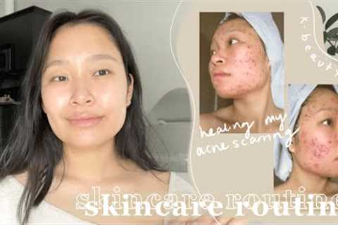 my holy grail skincare routine | how I healed my severe acne scarring, texture &amp;..