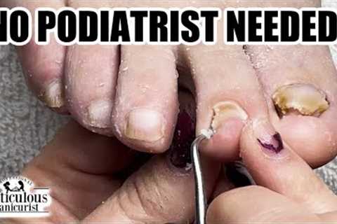 👣Learn How to Pedicure at Home with Conservative Care👣