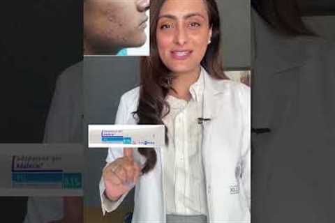 This or that | acne treatment options #dermatologist