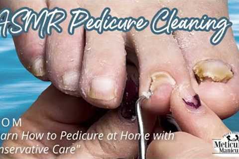 👣ASMR Pedicure Cleaning💆‍♀️Learn How to Pedicure at Home with Conservative Care👣