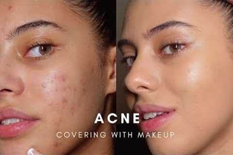 HOW TO: COVER ACNE WITH MAKEUP (BASE ROUTINE)