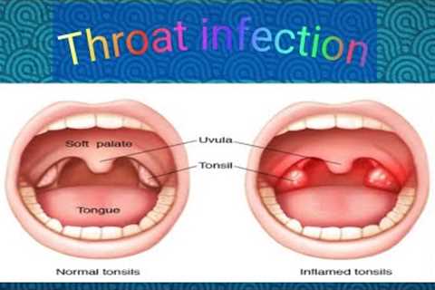 Throat infection । what is throat infection? how to solve it ?@HealthandEnvironmentfitness
