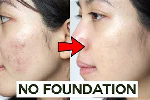 How to Cover Acne &amp; Blemishes WITHOUT Foundation  • easy &amp; non cakey