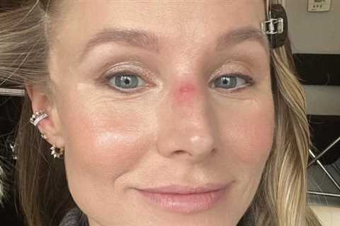 Kristen Bell Shares Jiu-Jitsu Nose Injury: 'You Should See The Other Guy'