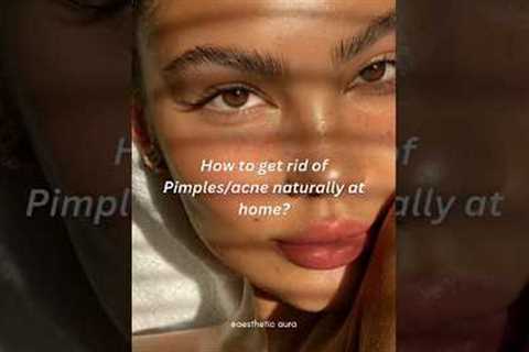 How to Get Rid of Pimples/acne naturally at home #glowup #pimpleproblem #getridofpimples #acne