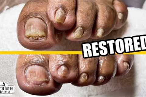 👣PEDICURE NEAR ME &amp; Reverse Unwanted Toenail Appearance with Conservative Care👣