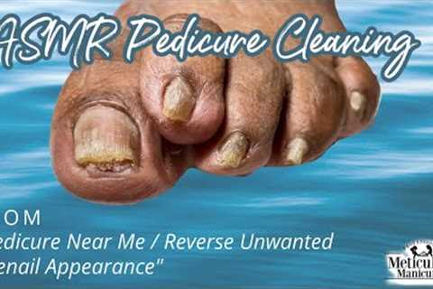 👣ASMR Pedicure Cleaning💆‍♀️Pedicure Near me &amp; Reverse Unwanted Toenail Appearance..