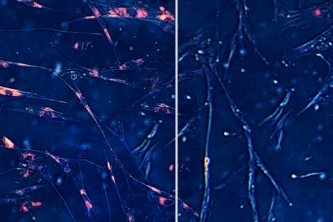Artificial intelligence can identify anti-aging drugs that target 'zombie cells'