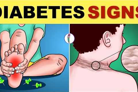 Diabetes Symptoms | Diabetes Mellitus | Type 2 Diabetes - Signs &amp; Symptoms | Diabetes Warning..