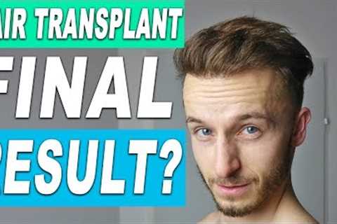 When To Expect the Final Result after Hair Transplant Surgery &amp; My Hairline