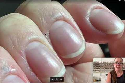 Swollen and puffy cuticles advice [Anna's Nail Advice]
