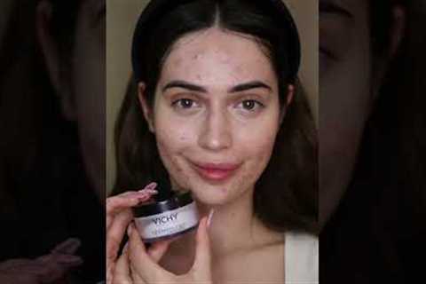 Hailey Bieber makeup tutorial, but on acne skin 🤍