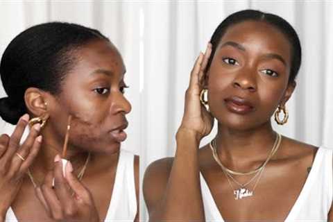 How To Cover Acne &amp; Acne Scars With NO FOUNDATION | Minimal Makeup Routine