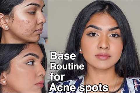 Flawless base routine for acne prone skin / acne pigmentation
