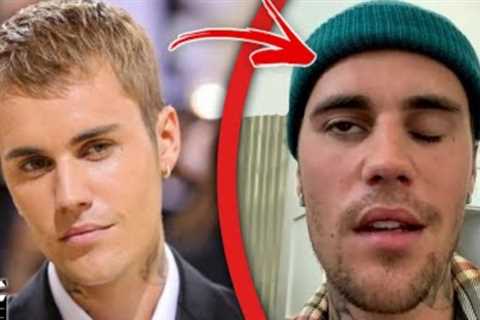 Celebrities caught faking their illnesses: Top 10.