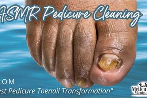 👣ASMR Pedicure Cleaning💆‍♀️Best Pedicure Toenail Transformation👣