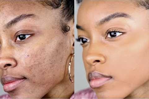 How to cover acne/dark spots WITHOUT a lot of makeup | Slim Reshae
