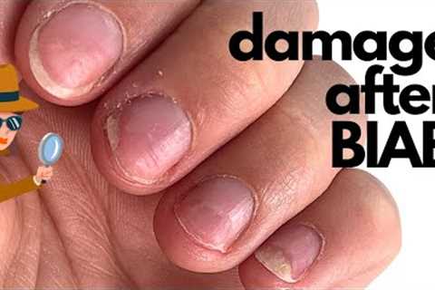 How to correct damage after BIAB? (Builder in a bottle) [Anna's Nail Advice]