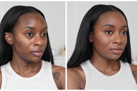 My NO FOUNDATION Summer Makeup Routine | Cover Acne Scars &amp; Hyperpigmentation Without Foundation