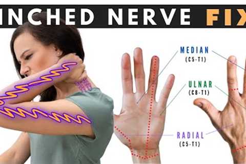 How to Fix a Pinched Nerve in the Neck | Dr. Jon Saunders