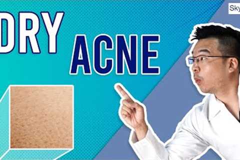 How To Treat Dry Skin + Acne (Dry Acne) | 5 Tips To Follow