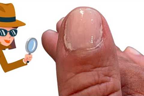 Why is my nail polish peeling? [shocking discovery]