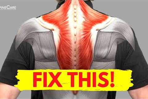 How to Fix Muscle Knots in Your Neck and Shoulder in 30 SECONDS